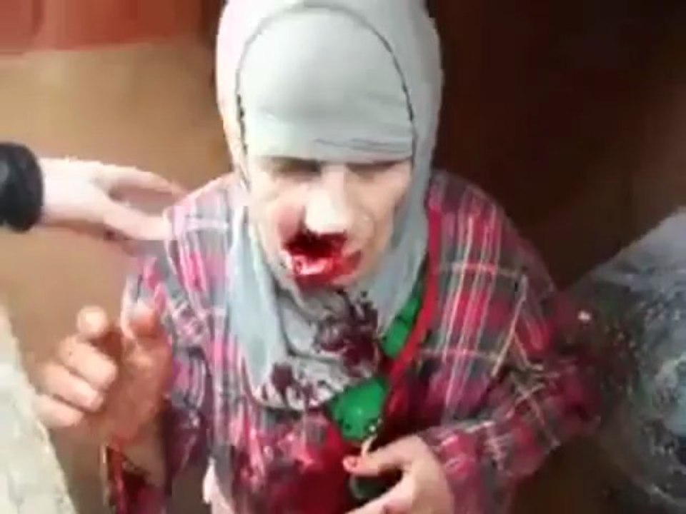 Une vieille dame touchée à la bouche en Syrie (choc)