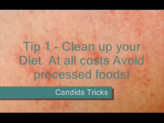 Candida Treatment Tricks