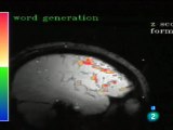 Trastornos mentales: Investigacion neurobiologica