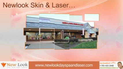 Acne treatment in New look Day Spa And Laser