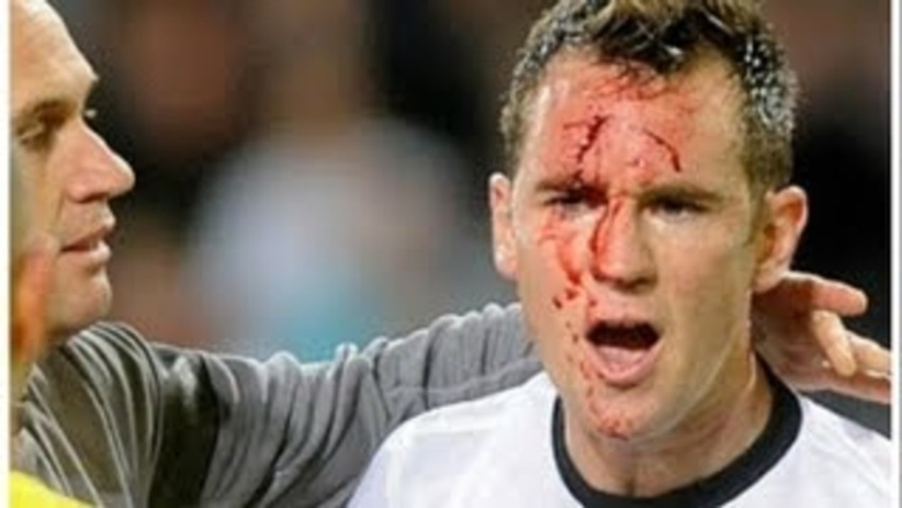 Un joueur s'essuie les crampons sur le visage d'un adversaire !