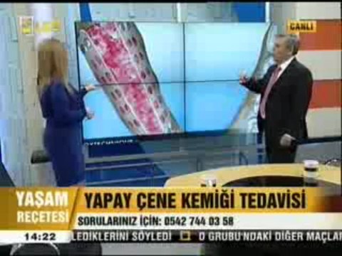 Yapay Çene Kemiği Tedavisi Nasıl Gerçekleştirilir?