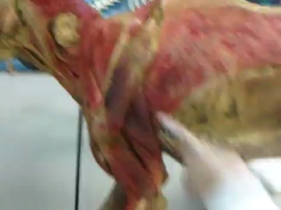 Anato II musculos extrinsecos miembro toracico