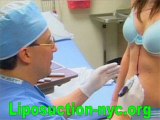 Risks Associated With NYC Liposuction surgery