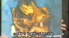 Avortul-imagini graitoare