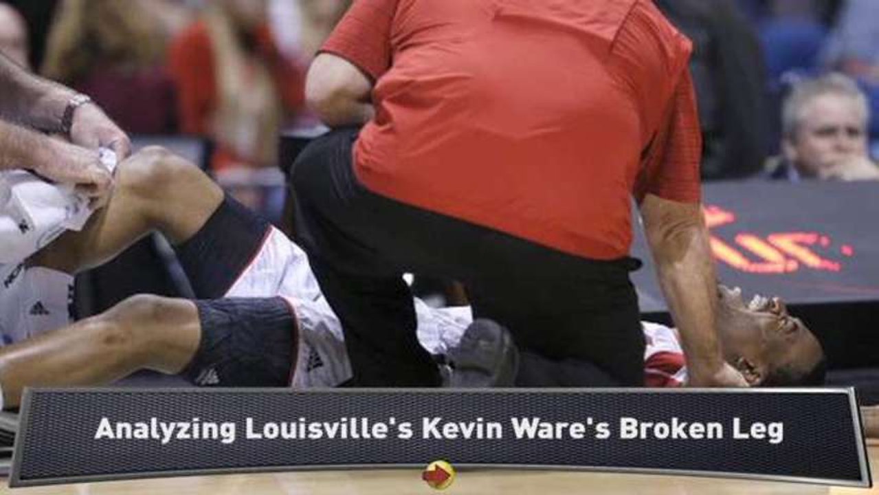 Analyzing Kevin Ware's Broken Leg - video Dailymotion