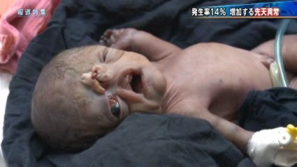 20130406_発生率１４％増加する先天異常イラク・ファルージャ