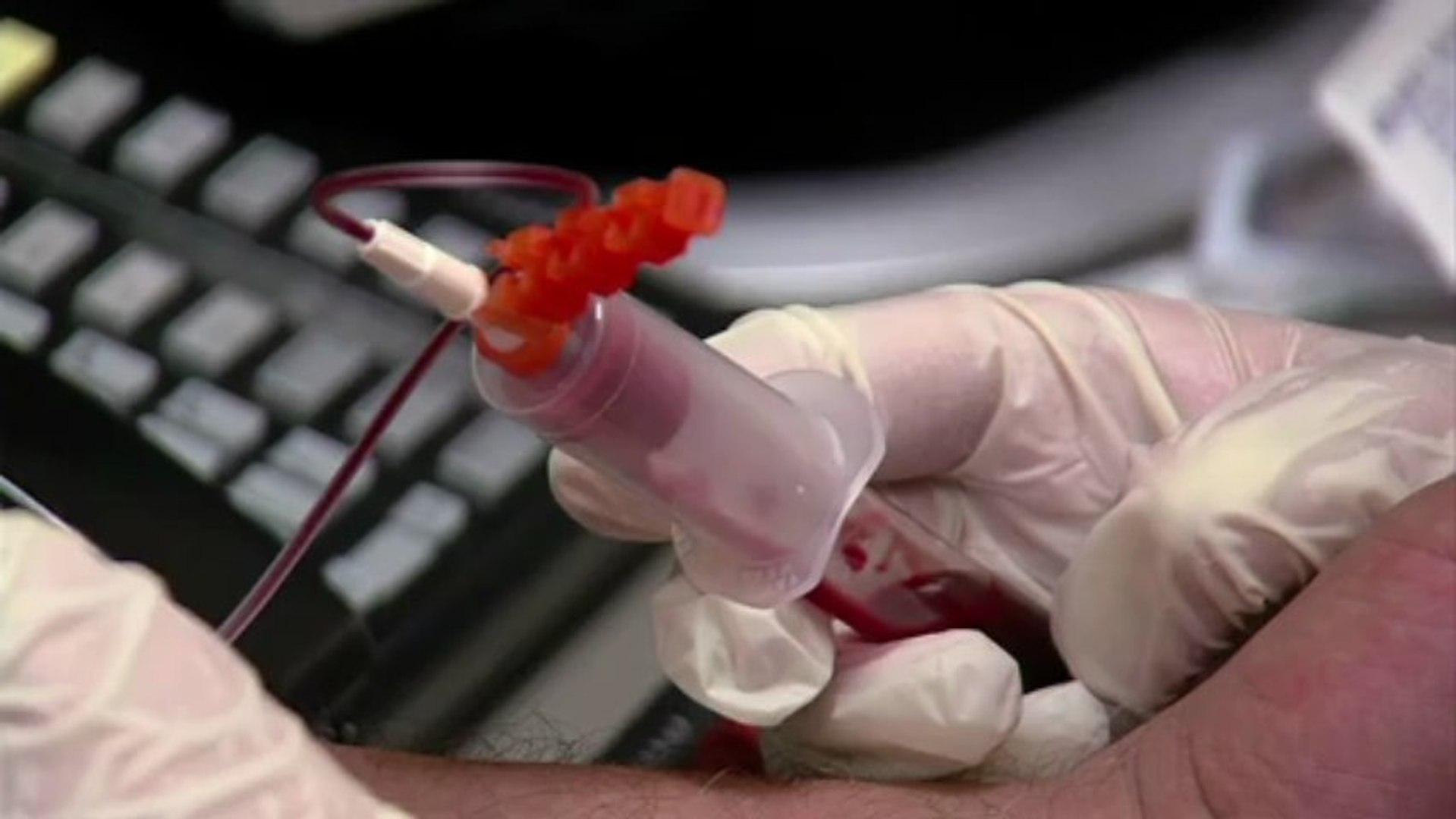 ⁣ACP Releases New Prostate Cancer Screening Recommendations