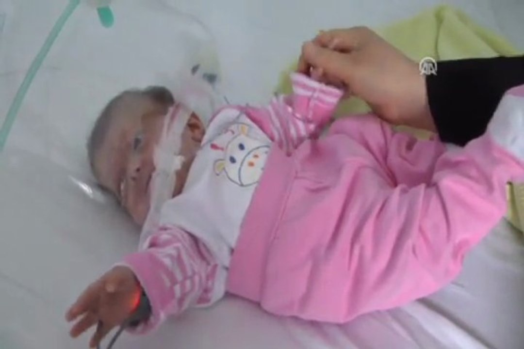 Parmak bebek taburcu oldu