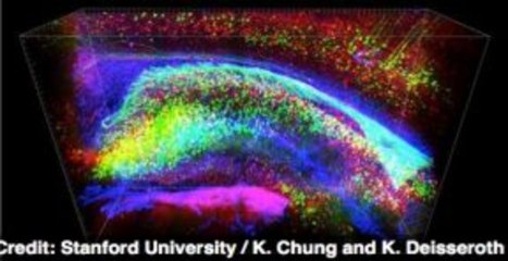 Scientists Make the Brain See-Through, Easier to Study