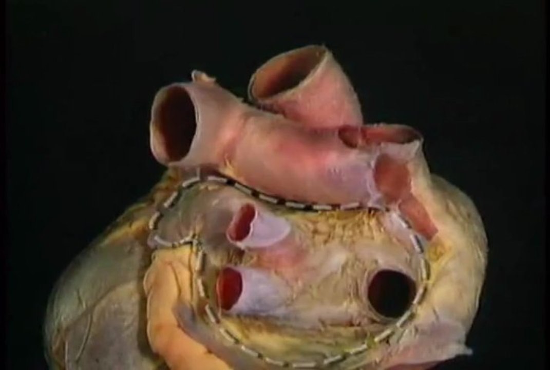 The Heart