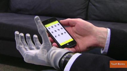 Company Creates Smartphone-Controlled Prosthetic Hand