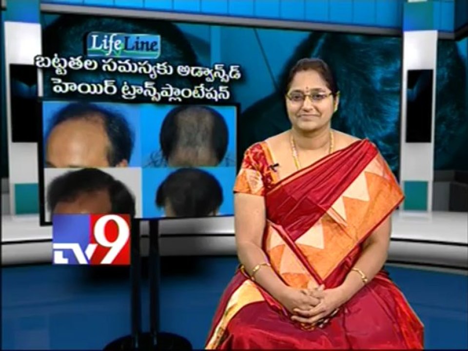 Baldness treated with Advanced Hair transplantation