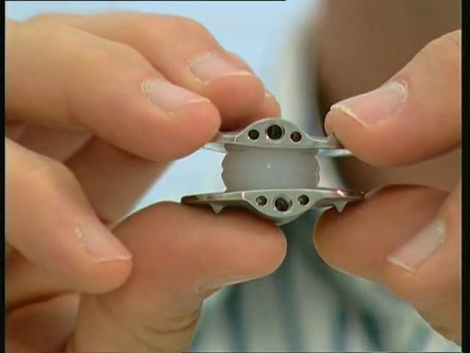 Künstliche Bandscheiben: neue Beweglichkeit ohne Schmerzen