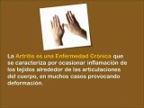 Remedios Caseros Contra La Artritis - practicos y efectivos consejos