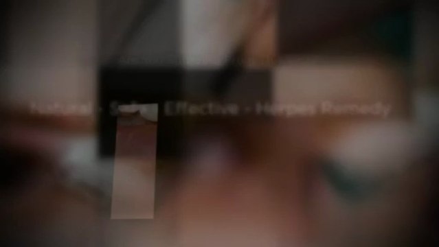 [Herpes Treatment] Cure Herpes Using Natural Remedy