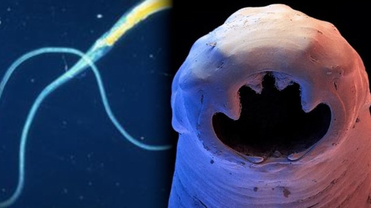 Can Parasitic Worms Help Treat Disease?