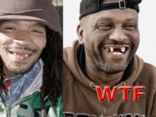 WTF A Trend Of Toothless Smile