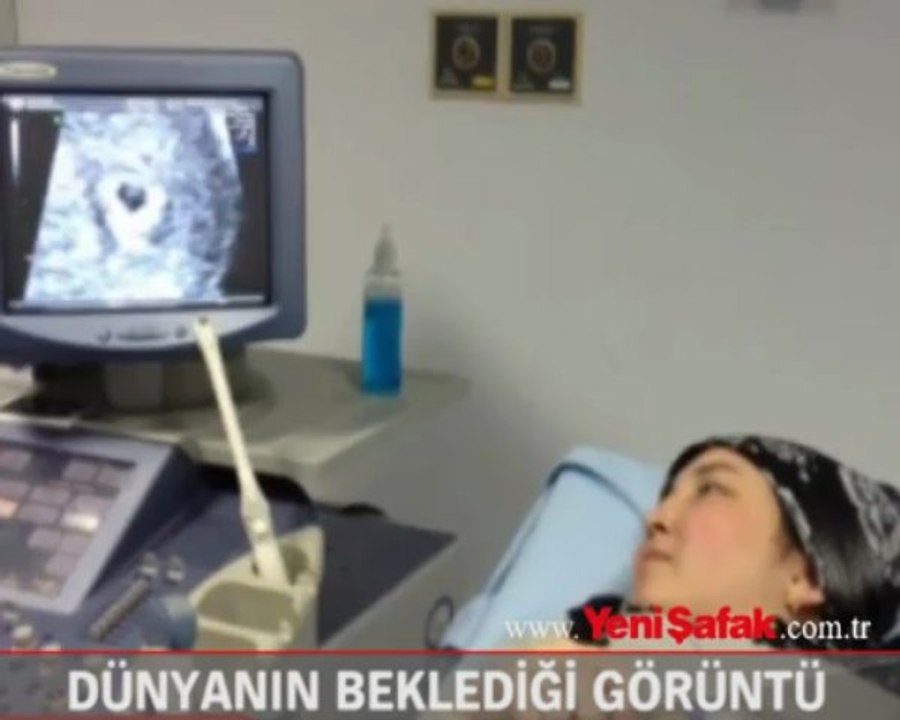 Dünyanın beklediği görüntü