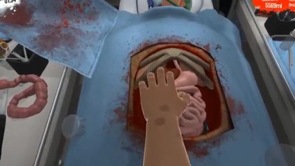 I Broke Surgeon Simulator 2013