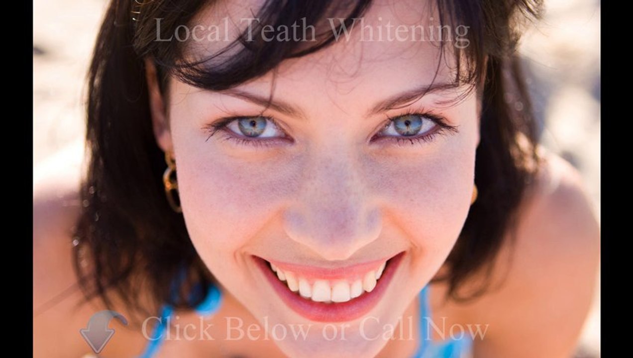 Teeth Whitening Toronto - Call Now (877)399-9477