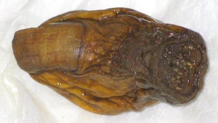 Man Drinks Toe, Angers Canada