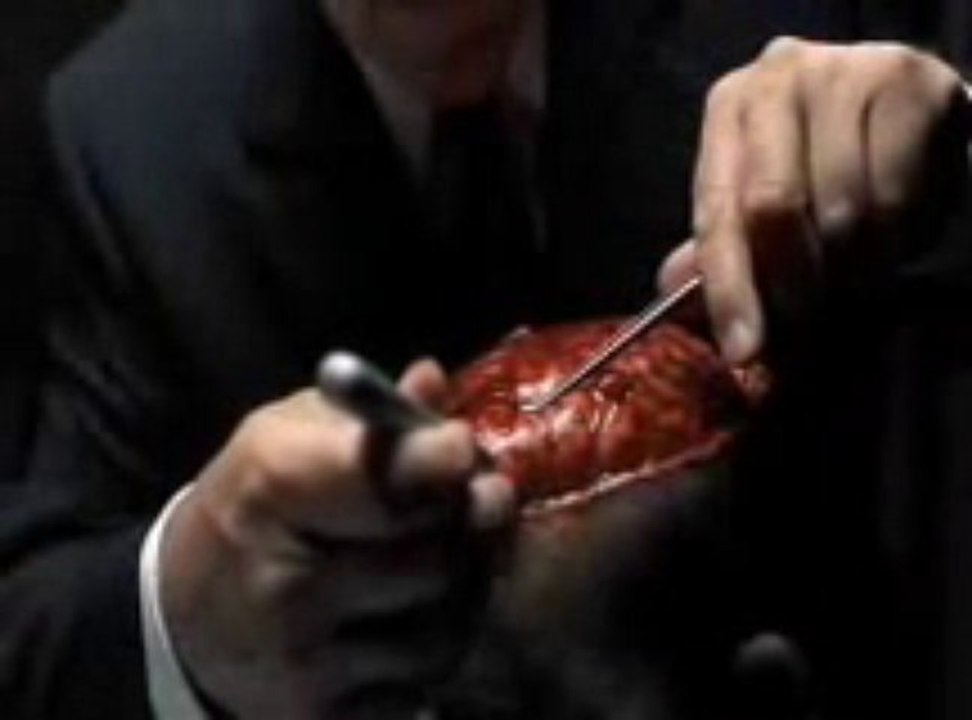 Hannibal Video Mashup  Chapter 4 - A7X