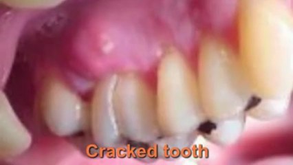 Emergency Dental Care