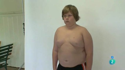 Campamento para obesos