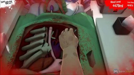 Soluce Surgeon Simulator 2013 : opération secrète