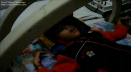 cerebral palsy treated with rTMS