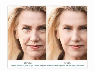 Anti Aging Skin Care