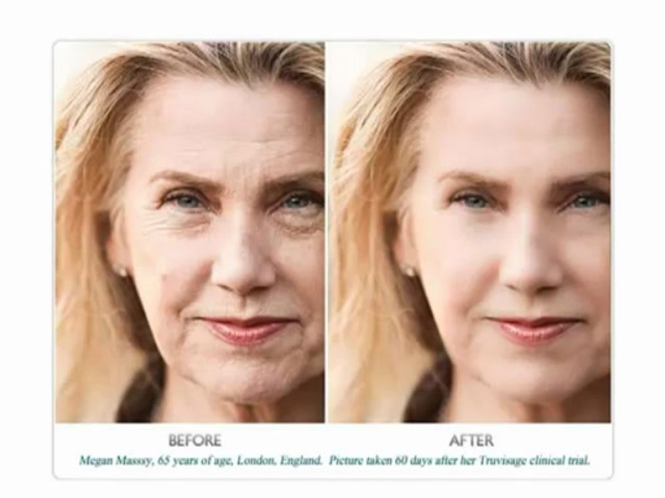 Anti Aging Supplements