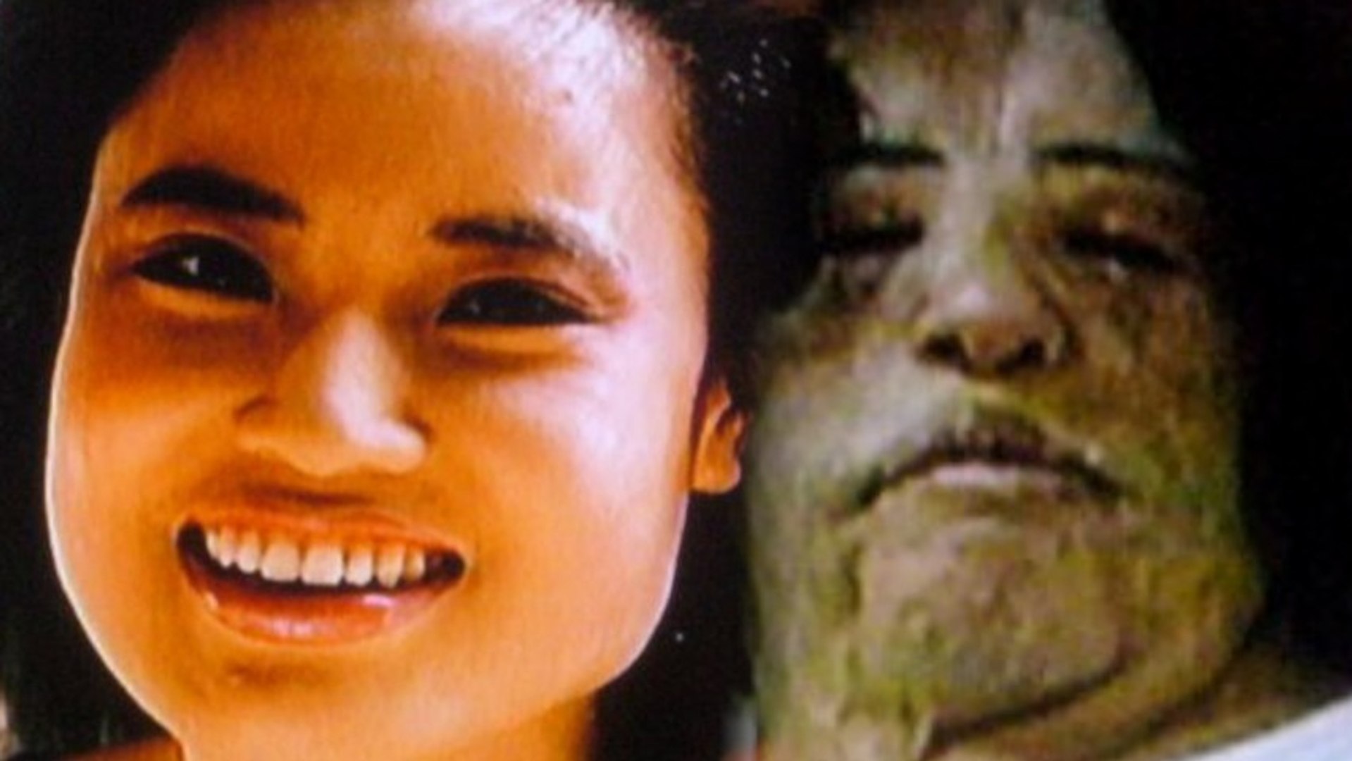 ⁣Former Model Permanently Disfigured After Plastic Surgery