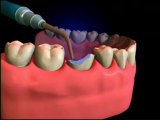 Dr Abid Faqir - Core Build Up Dental