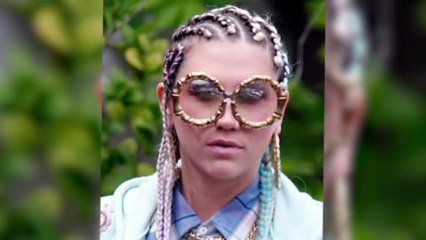 Ke$ha Predictably Films 'Crazy Kids' Looking Like a Lunatic