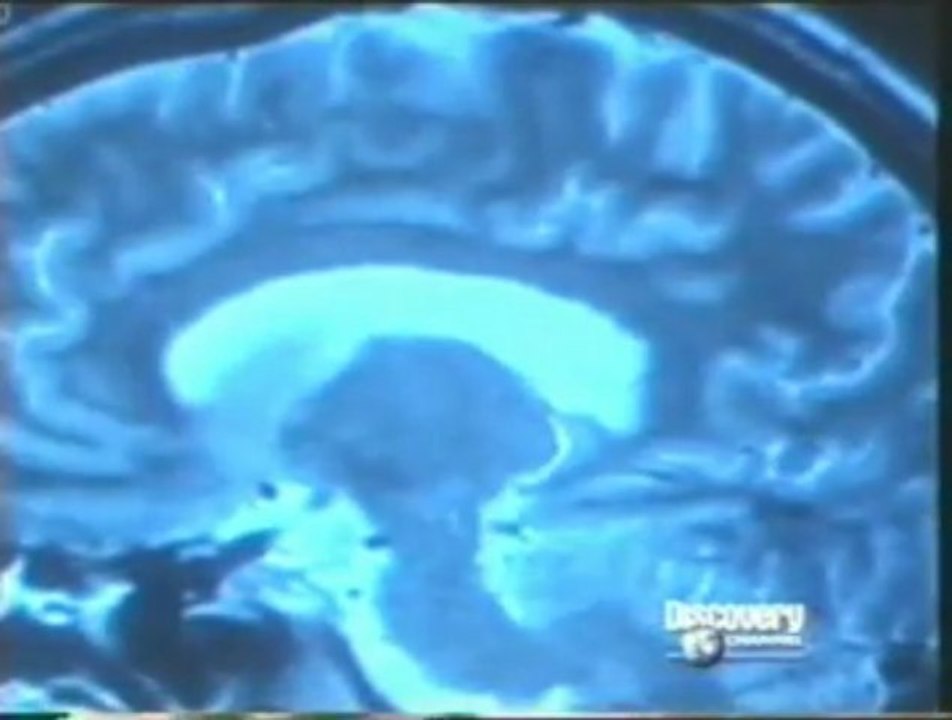 Neurociencia de las cosquillas (RMf): Risa en el cerebro (S. Blackmore)