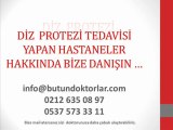 Diz Protezi Tedavisi,Diz Protezi Tedavisi Fiyatları,Diz Protezi Tedavisi SGK