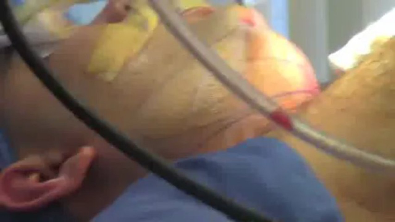 Un artiste a fabriqué des savons avec sa propre graisse