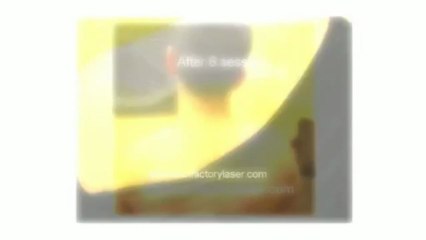 Laser Tattoo Removal In Las Vegas