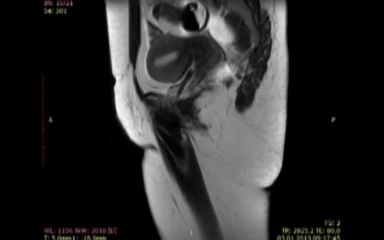 Prof.Dr Kayhan Günay - MR Dekografi