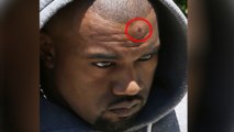 Kanye West Bangs His Head on a Sign Post