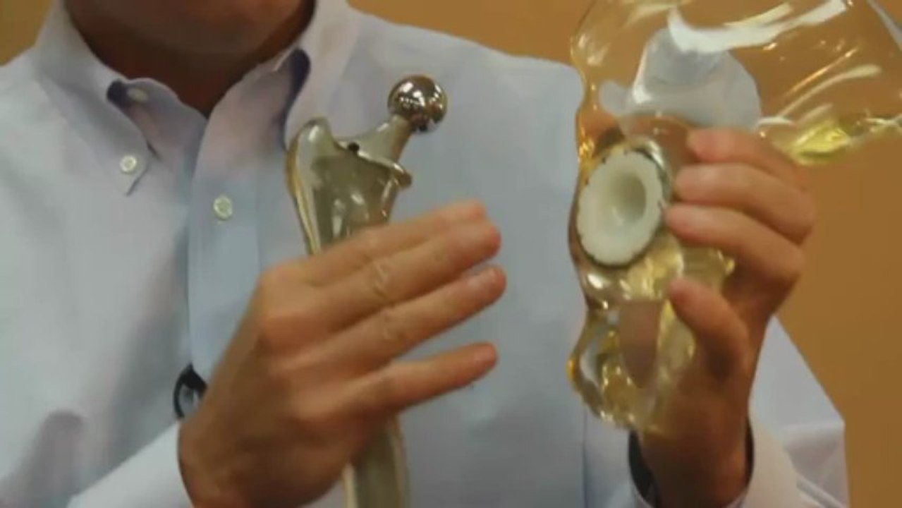 All About Hip Replacement Surgery by St Pete Hip and Knee