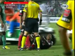 Palmeiras vs Tijuana 2: Exciting Match Recap ⚽