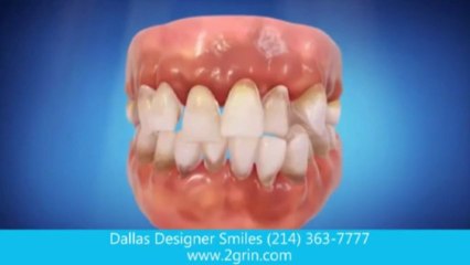 Dallas Designer Smiles reviews dallas