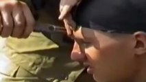 Russian Soldier Smiles For The Camera As A Bullet Is Pulled