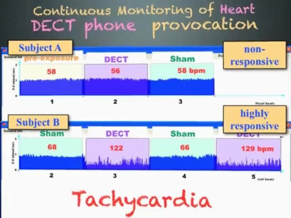 Electrohypersensitivity, Cell Phone Radiation Exposure