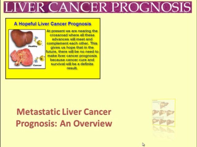 Liver Cancer Prognosis