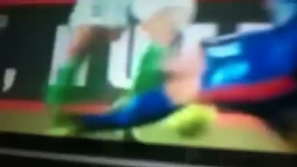 OUILLE SA DOIT FAIRE MAL :)