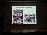 PANCREAS SOLITARY CYSTS - Dr Marie-Pierre VULIIERME